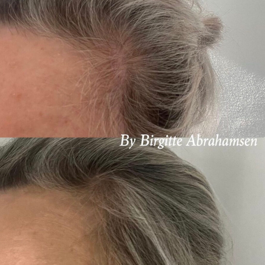hairfiller-risskov-aarhus